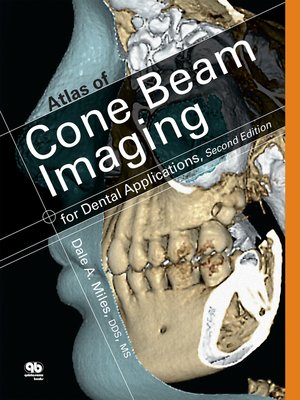 cover image of Atlas of Cone Beam Imaging for Dental Applications